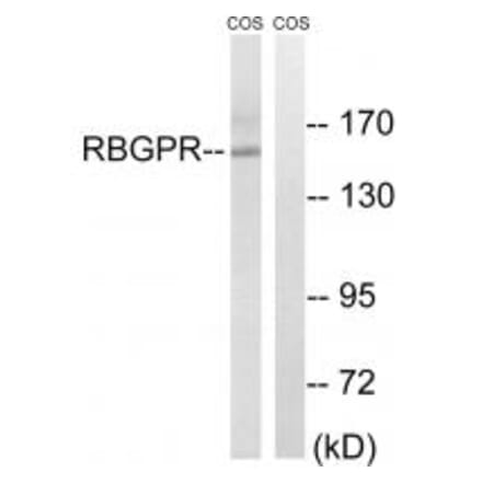 Western blot - RAB3GAP2 Antibody from Signalway Antibody (34951) - Antibodies.com