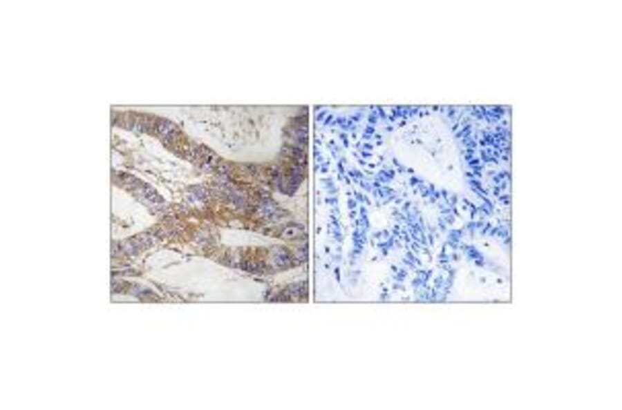 Immunohistochemistry - SERPINB9 Antibody from Signalway Antibody (35037) - Antibodies.com