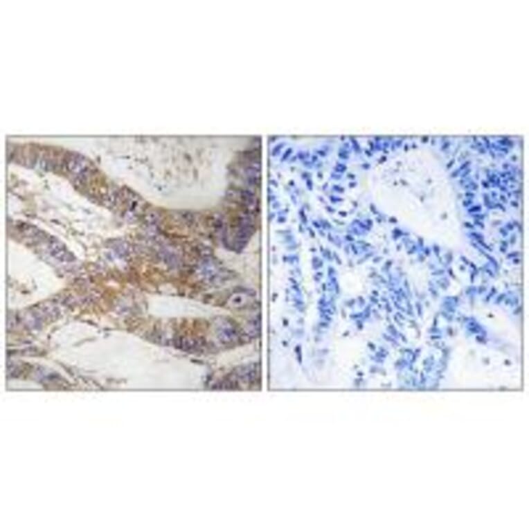 Immunohistochemistry - SERPINB9 Antibody from Signalway Antibody (35037) - Antibodies.com