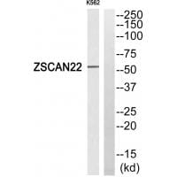 Western blot analysis of extracts from K562 cells, using ZSCAN22 antibody #35151.