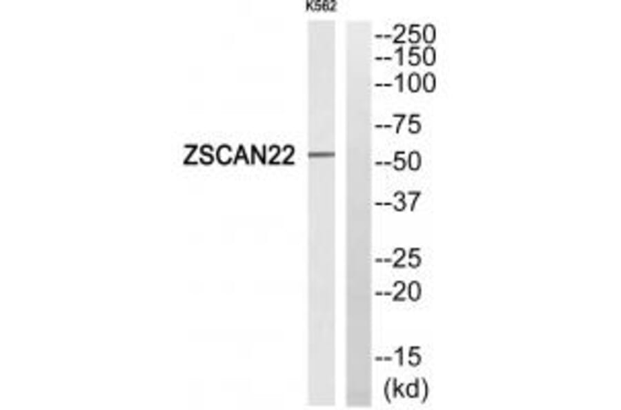 Western blot - ZSCAN22 Antibody from Signalway Antibody (35151) - Antibodies.com