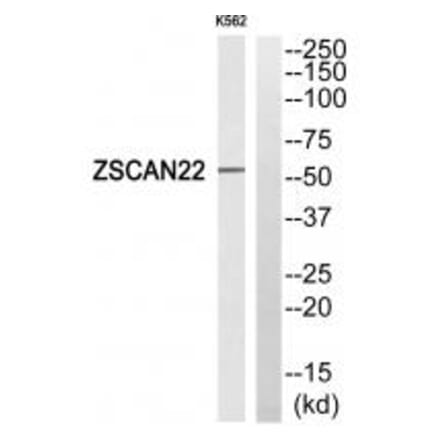 Western blot - ZSCAN22 Antibody from Signalway Antibody (35151) - Antibodies.com