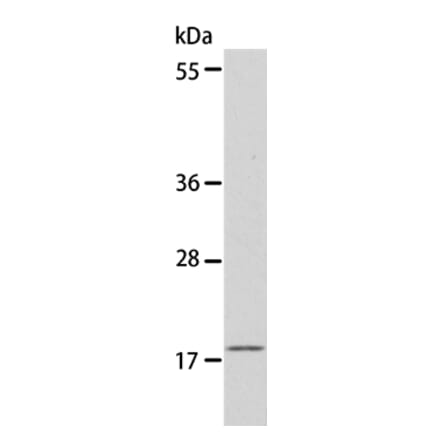 EIF4EBP1 Antibody from Signalway Antibody (35610) - Antibodies.com