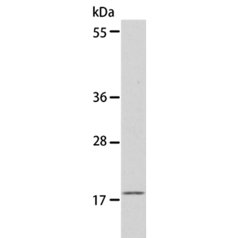 EIF4EBP1 Antibody from Signalway Antibody (35610) - Antibodies.com