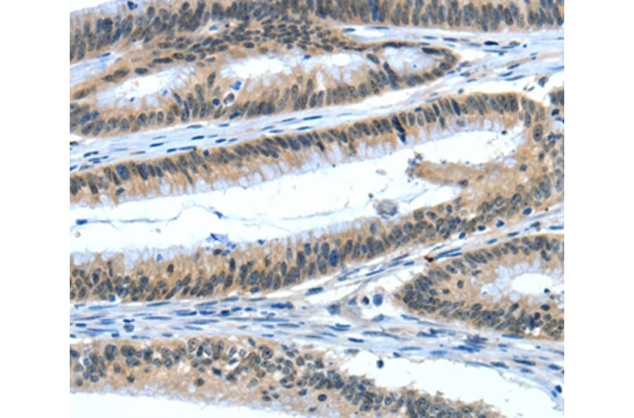 Immunohistochemistry - EIF4EBP1 Antibody from Signalway Antibody (35610) - Antibodies.com