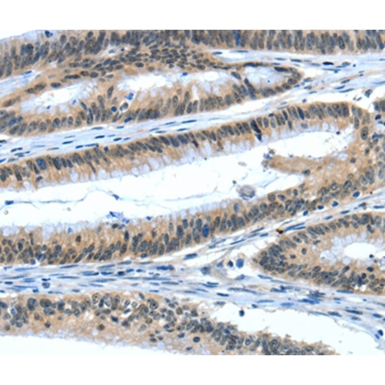 Immunohistochemistry - EIF4EBP1 Antibody from Signalway Antibody (35610) - Antibodies.com