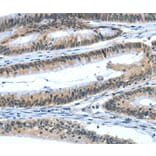 Immunohistochemistry - EIF4EBP1 Antibody from Signalway Antibody (35610) - Antibodies.com