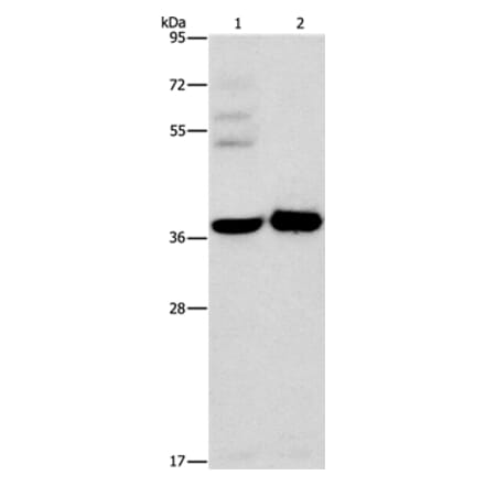 SERPINE2 Antibody from Signalway Antibody (35862) - Antibodies.com