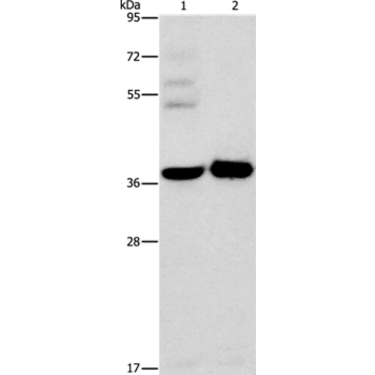 SERPINE2 Antibody from Signalway Antibody (35862) - Antibodies.com