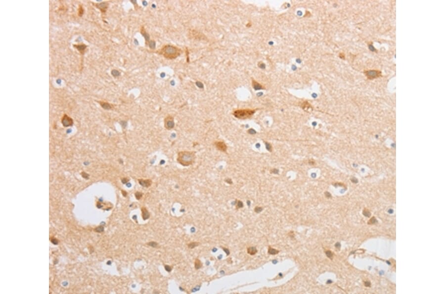 Immunohistochemistry - SERPINE2 Antibody from Signalway Antibody (35862) - Antibodies.com