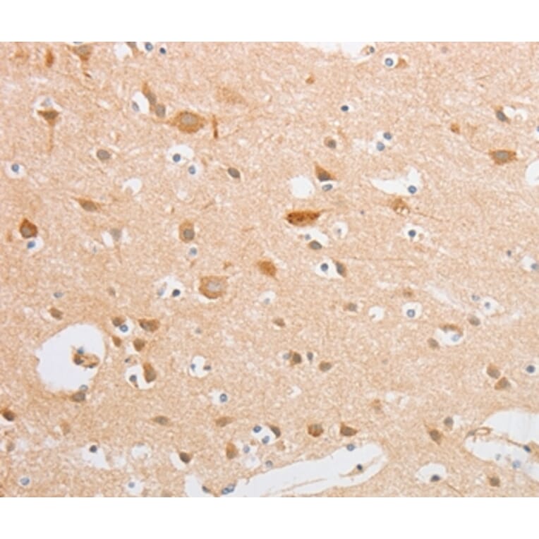 Immunohistochemistry - SERPINE2 Antibody from Signalway Antibody (35862) - Antibodies.com