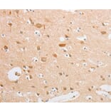 Immunohistochemistry - SERPINE2 Antibody from Signalway Antibody (35862) - Antibodies.com
