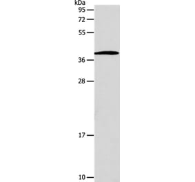 SLC25A11 Antibody from Signalway Antibody (35918) - Antibodies.com