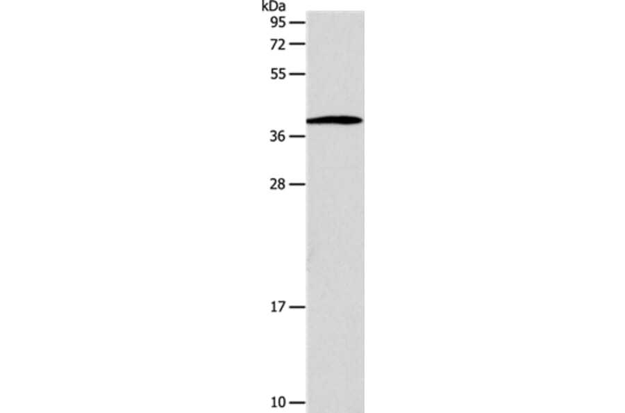 SLC25A11 Antibody from Signalway Antibody (35918) - Antibodies.com