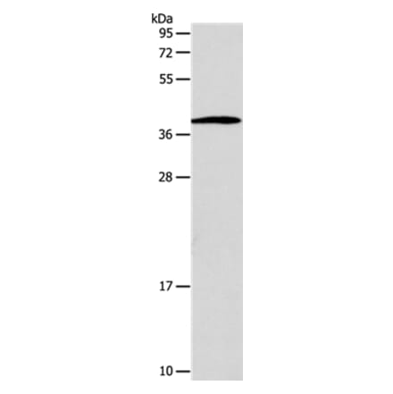 SLC25A11 Antibody from Signalway Antibody (35918) - Antibodies.com