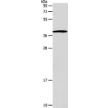 SLC25A11 Antibody from Signalway Antibody (35918) - Antibodies.com