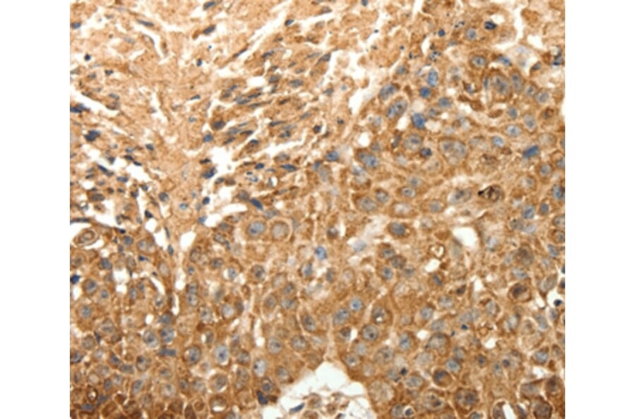 Immunohistochemistry - SLC25A11 Antibody from Signalway Antibody (35918) - Antibodies.com