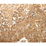 Immunohistochemistry - SLC25A11 Antibody from Signalway Antibody (35918) - Antibodies.com