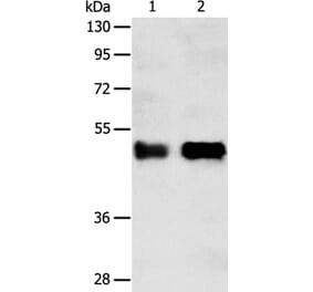 SERPINA5 Antibody from Signalway Antibody (35991) - Antibodies.com