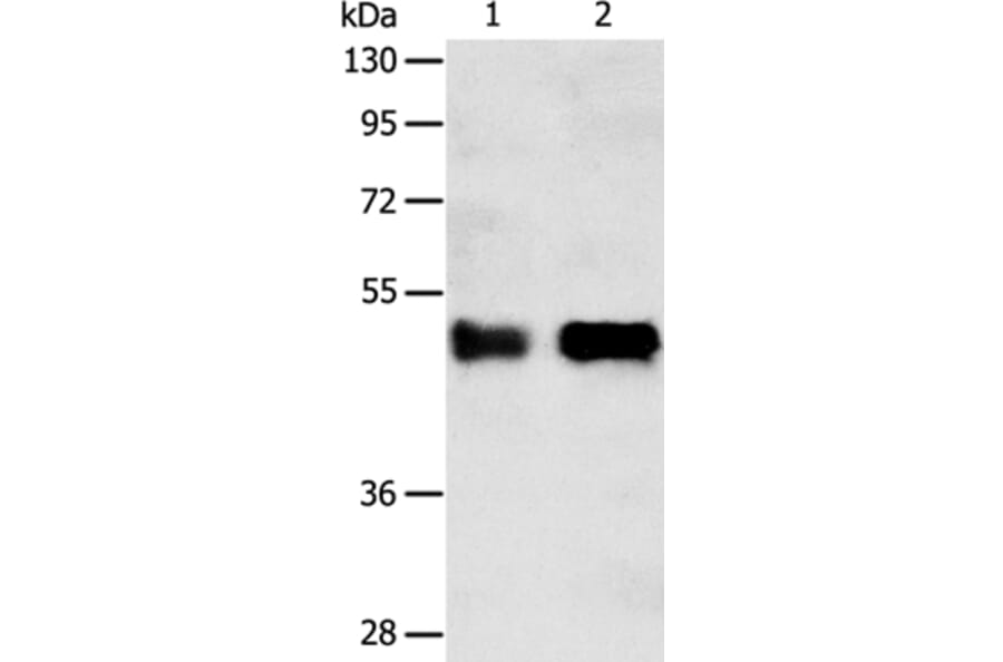 SERPINA5 Antibody from Signalway Antibody (35991) - Antibodies.com