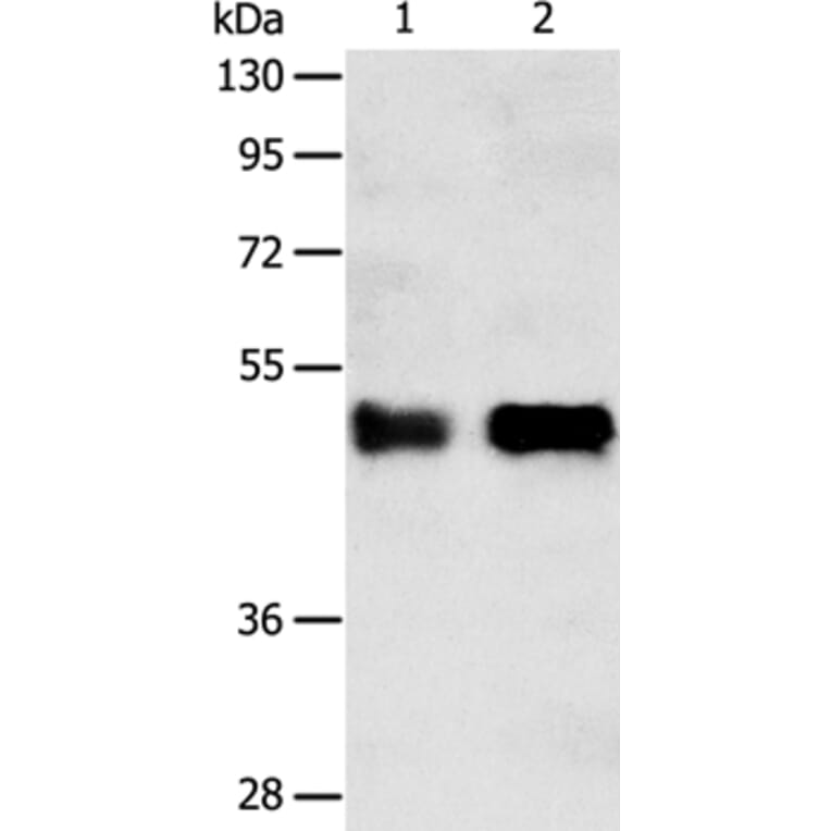 SERPINA5 Antibody from Signalway Antibody (35991) - Antibodies.com