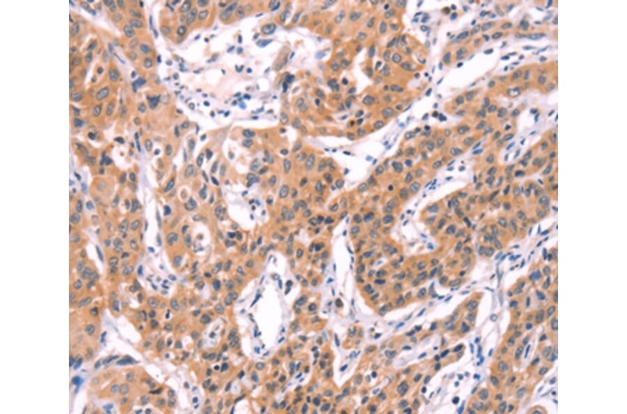 Immunohistochemistry - SERPINA5 Antibody from Signalway Antibody (35991) - Antibodies.com