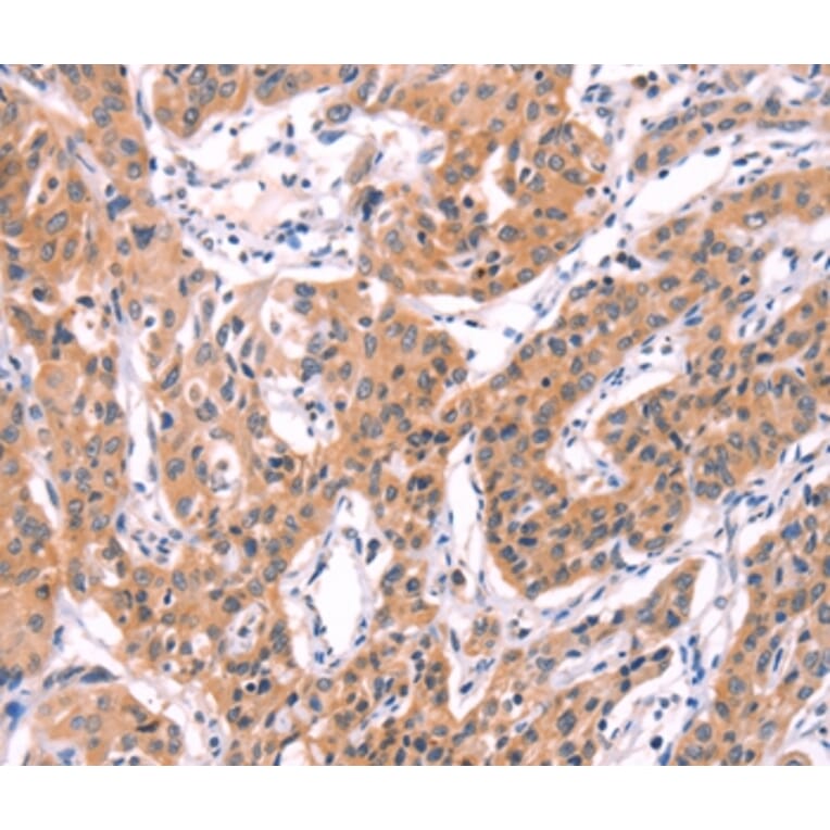 Immunohistochemistry - SERPINA5 Antibody from Signalway Antibody (35991) - Antibodies.com
