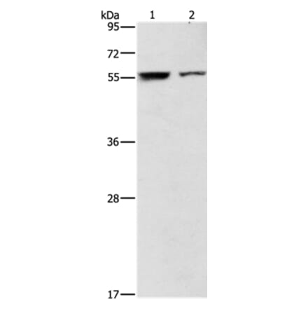 ARHGAP15 Antibody from Signalway Antibody (36131) - Antibodies.com