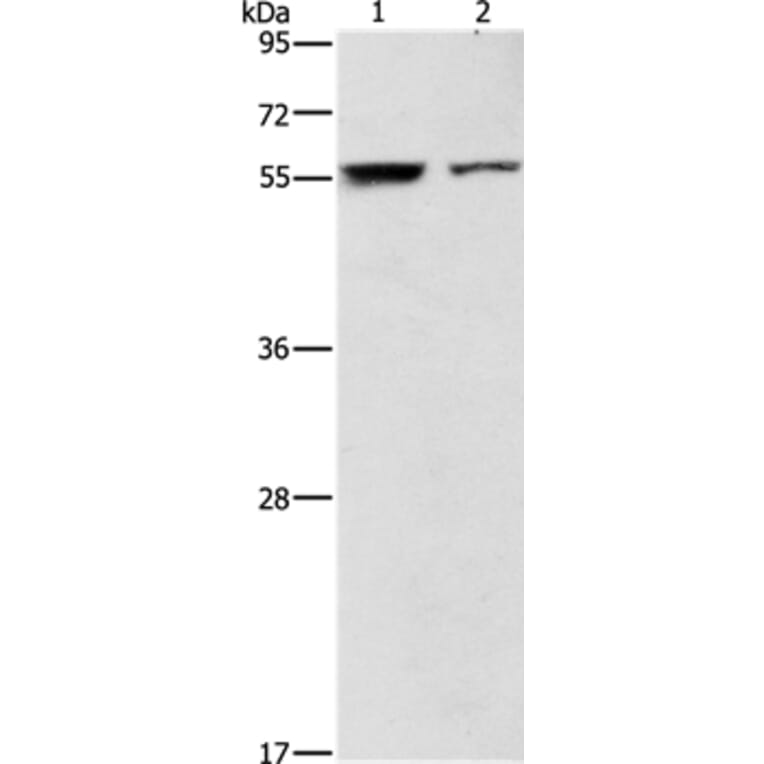 ARHGAP15 Antibody from Signalway Antibody (36131) - Antibodies.com