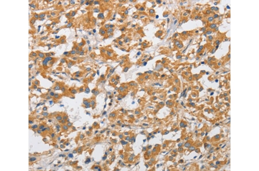 Immunohistochemistry - ARHGAP15 Antibody from Signalway Antibody (36131) - Antibodies.com