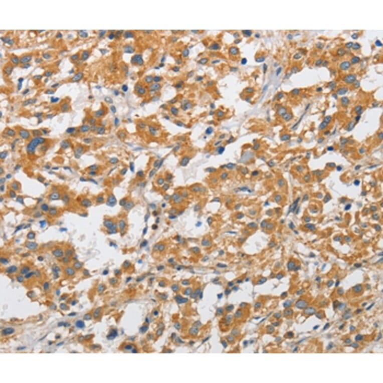 Immunohistochemistry - ARHGAP15 Antibody from Signalway Antibody (36131) - Antibodies.com