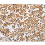 Immunohistochemistry - ARHGAP15 Antibody from Signalway Antibody (36131) - Antibodies.com
