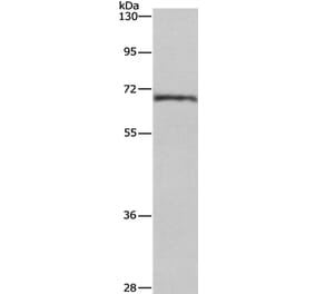 CDK5RAP3 Antibody from Signalway Antibody (36335) - Antibodies.com