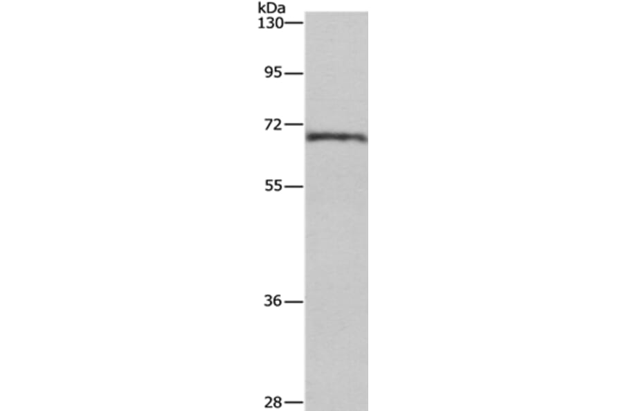 CDK5RAP3 Antibody from Signalway Antibody (36335) - Antibodies.com