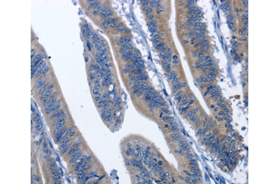 Immunohistochemistry - CDK5RAP3 Antibody from Signalway Antibody (36335) - Antibodies.com