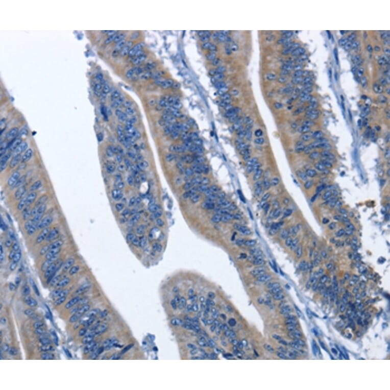 Immunohistochemistry - CDK5RAP3 Antibody from Signalway Antibody (36335) - Antibodies.com