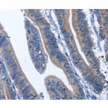 Immunohistochemistry - CDK5RAP3 Antibody from Signalway Antibody (36335) - Antibodies.com