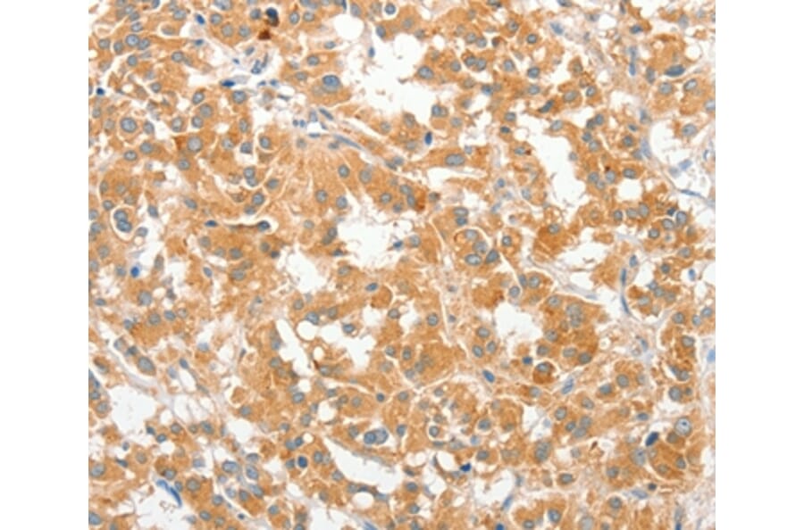 Immunohistochemistry - COL4A3BP Antibody from Signalway Antibody (36362) - Antibodies.com