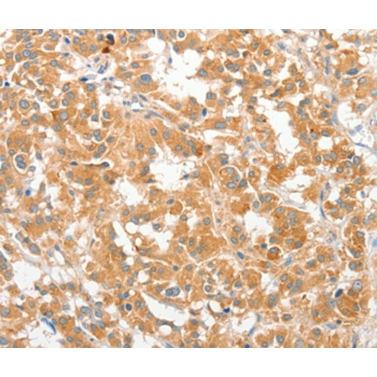 Immunohistochemistry - COL4A3BP Antibody from Signalway Antibody (36362) - Antibodies.com