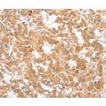 Immunohistochemistry - COL4A3BP Antibody from Signalway Antibody (36362) - Antibodies.com