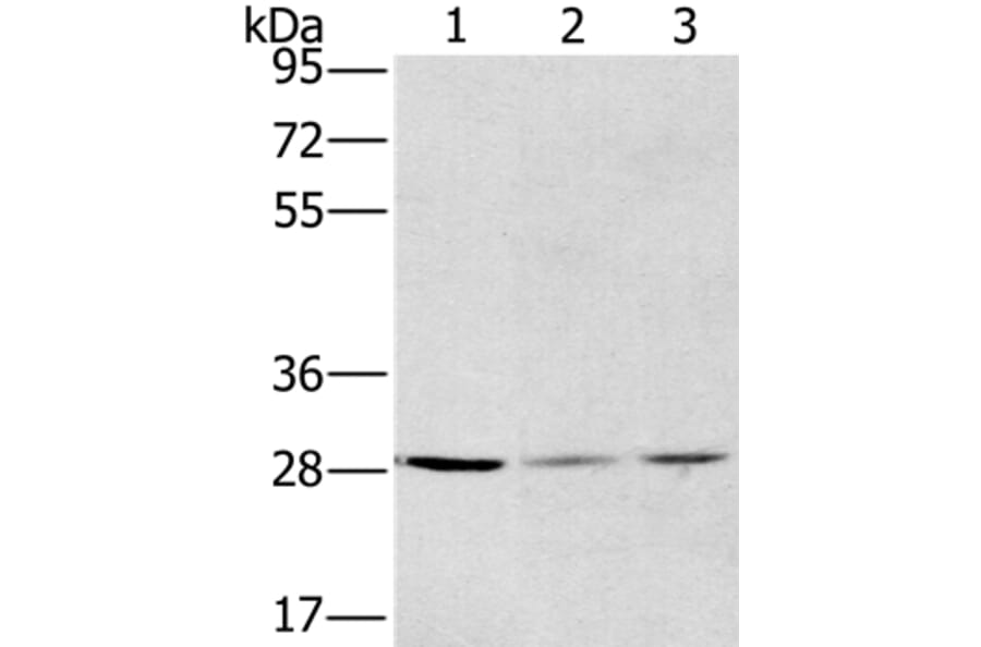 HSD17B12 Antibody from Signalway Antibody (36529) - Antibodies.com