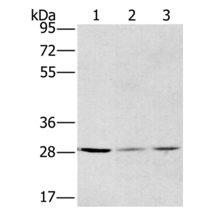 HSD17B12 Antibody from Signalway Antibody (36529) - Antibodies.com