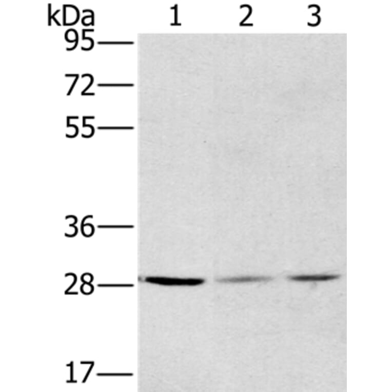 HSD17B12 Antibody from Signalway Antibody (36529) - Antibodies.com