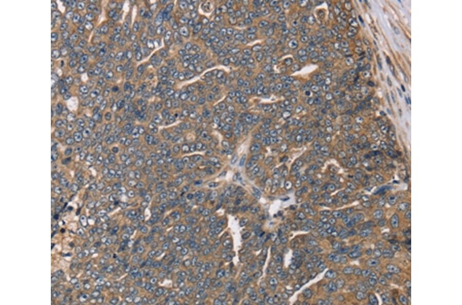 Immunohistochemistry - HSD17B12 Antibody from Signalway Antibody (36529) - Antibodies.com