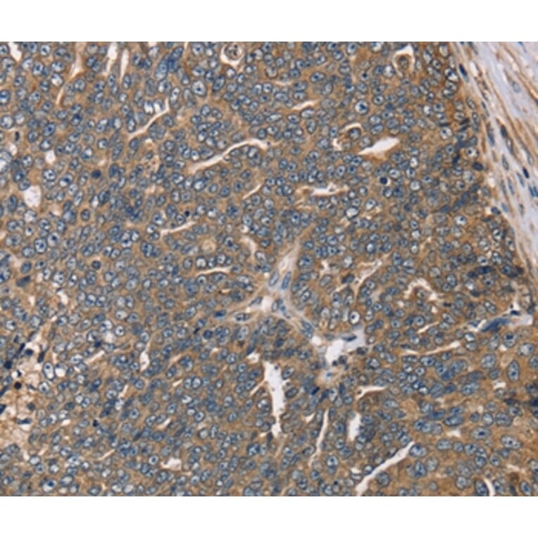 Immunohistochemistry - HSD17B12 Antibody from Signalway Antibody (36529) - Antibodies.com