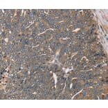 Immunohistochemistry - HSD17B12 Antibody from Signalway Antibody (36529) - Antibodies.com