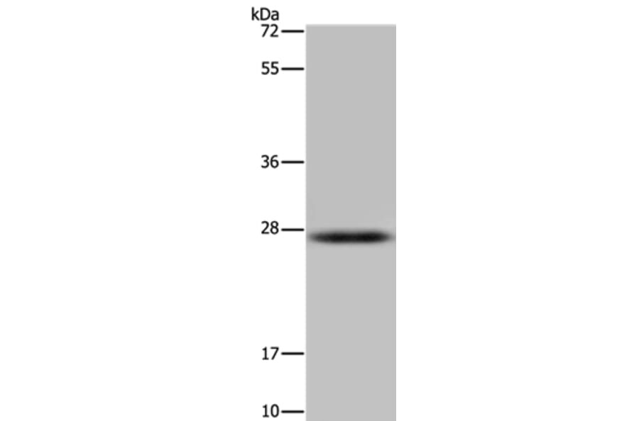 HSD17B14 Antibody from Signalway Antibody (36532) - Antibodies.com