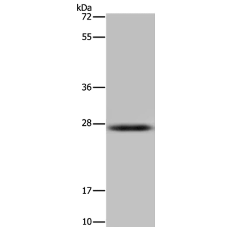 HSD17B14 Antibody from Signalway Antibody (36532) - Antibodies.com