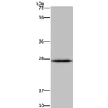 HSD17B14 Antibody from Signalway Antibody (36532) - Antibodies.com