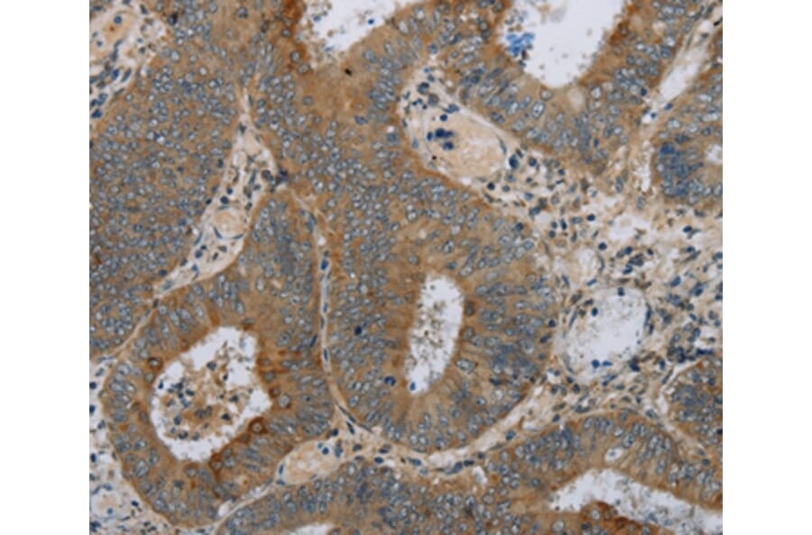 Immunohistochemistry - HSD17B14 Antibody from Signalway Antibody (36532) - Antibodies.com